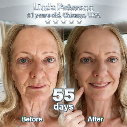 𝑷𝒖𝒓𝒆𝒍𝒖𝒙𝒐® Stem Cell–Inspired & GHK-Cu Powered Wrinkle-Refining Serum（Advanced Anti-Aging for Timeless, Radiant Skin)