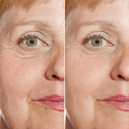 𝑷𝒖𝒓𝒆𝒍𝒖𝒙𝒐® Stem Cell–Inspired & GHK-Cu Powered Wrinkle-Refining Serum（Advanced Anti-Aging for Timeless, Radiant Skin)