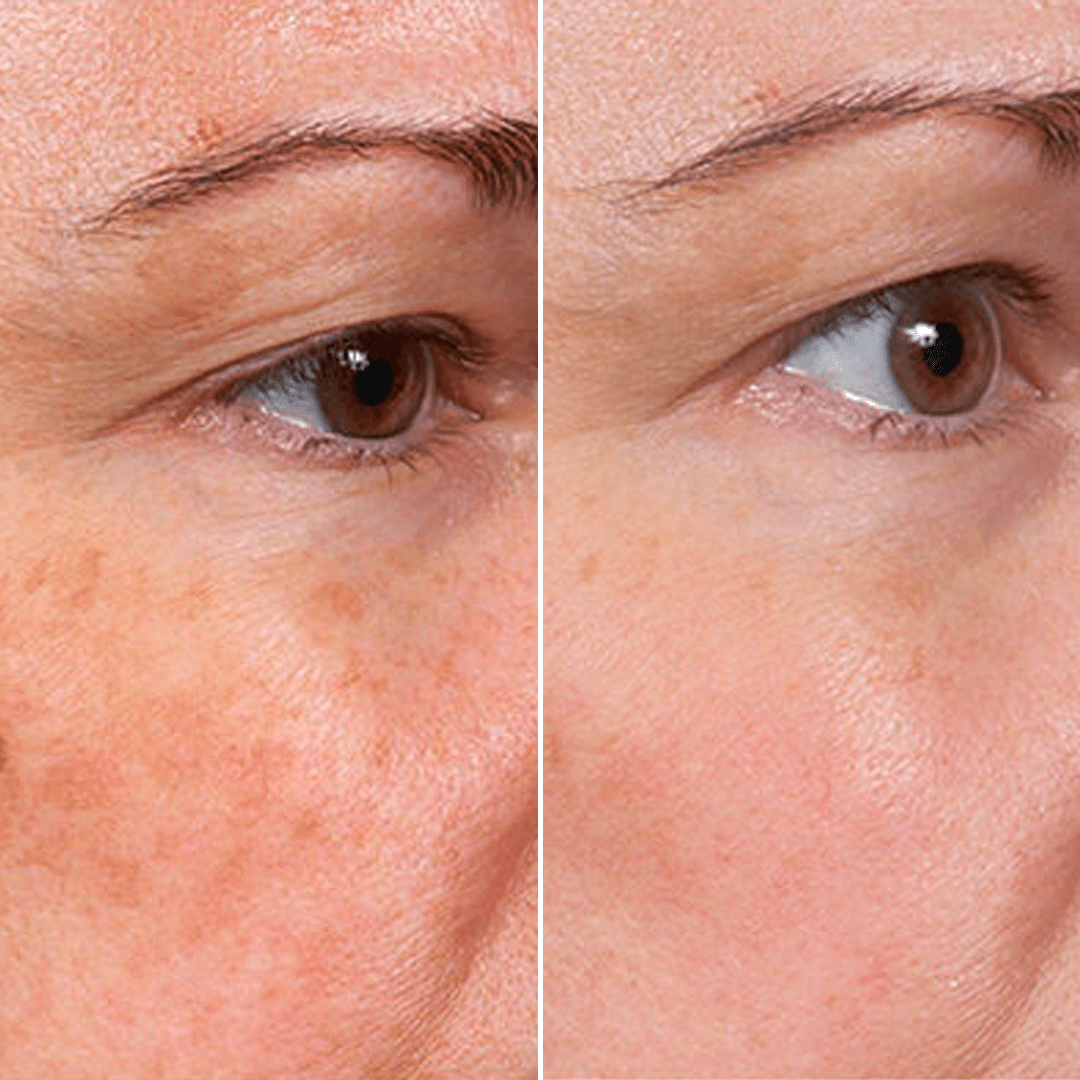 𝑷𝒖𝒓𝒆𝒍𝒖𝒙𝒐® Stem Cell–Inspired & GHK-Cu Powered Wrinkle-Refining Serum（Advanced Anti-Aging for Timeless, Radiant Skin)