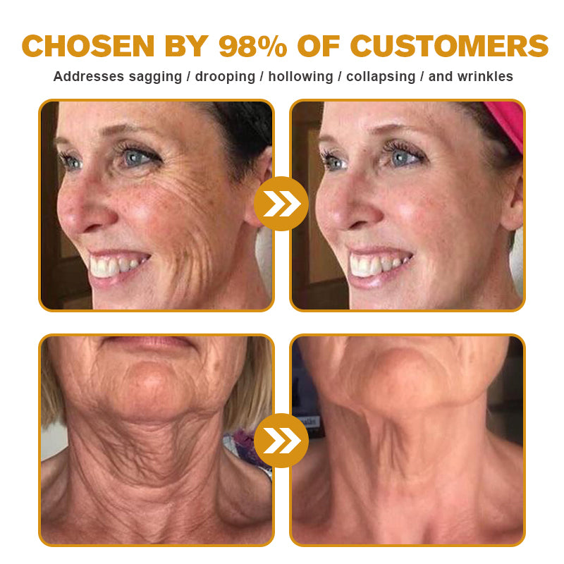 🧑‍⚕️Pureluxo® Botox Bee Venom Wrinkle Removal Cream- LAST DAY 90% OFF🧑‍⚕️