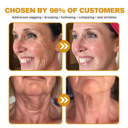 🧑‍⚕️Pureluxo® Botox Bee Venom Wrinkle Removal Cream- LAST DAY 90% OFF🧑‍⚕️