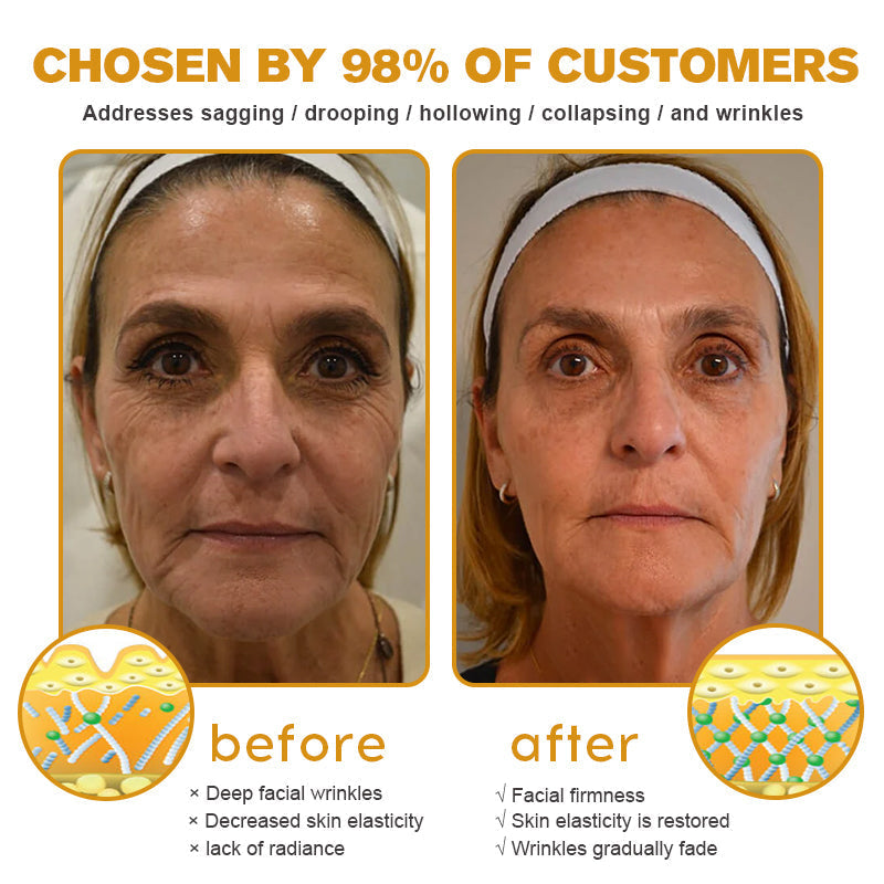 🧑‍⚕️Pureluxo® Botox Bee Venom Wrinkle Removal Cream- LAST DAY 90% OFF🧑‍⚕️