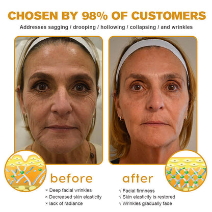 🧑‍⚕️Pureluxo® Botox Bee Venom Wrinkle Removal Cream- LAST DAY 90% OFF🧑‍⚕️